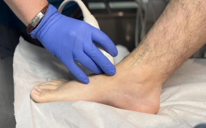 Imagen sobre "Ecografía de Cadera, Tobillo y Pie"