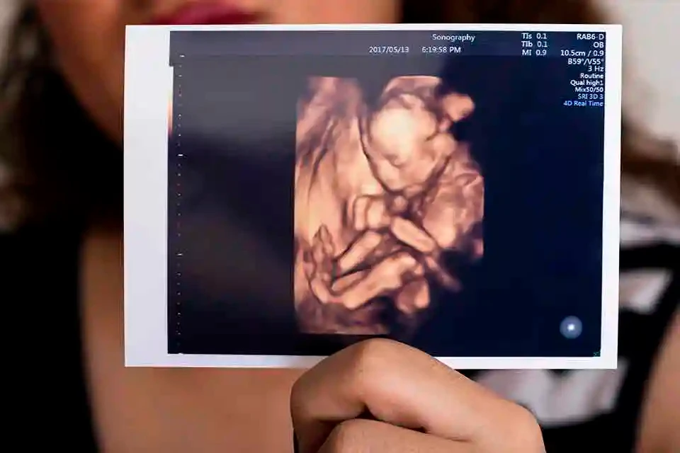 Imagen sobre "Ecografía Morfológica (Semana 20-24)"