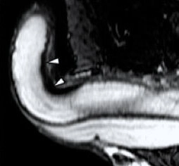 Imagen sobre "Ecografía de Pene"
